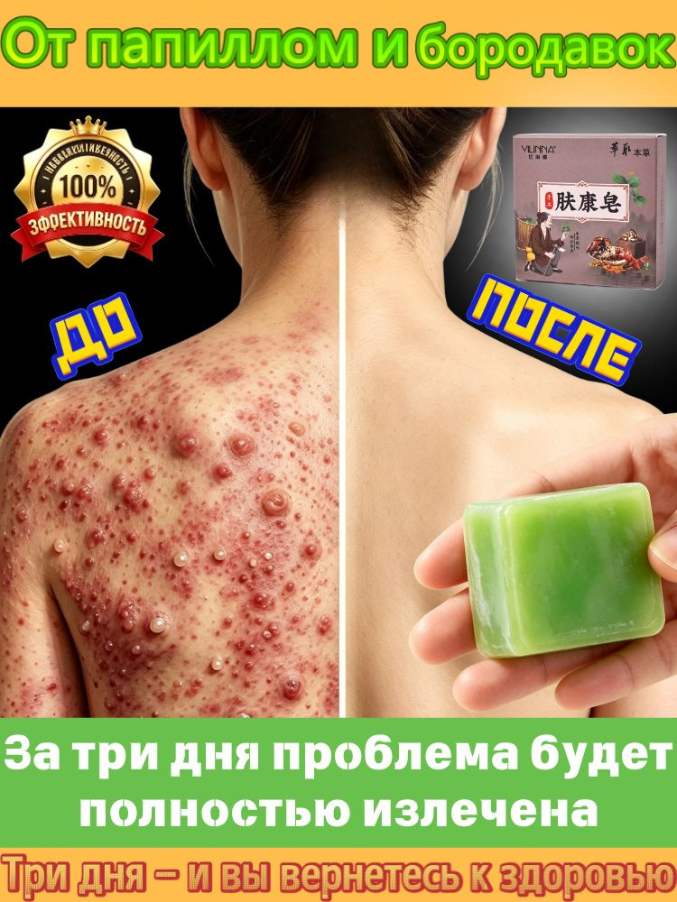 Твердое мыло #1