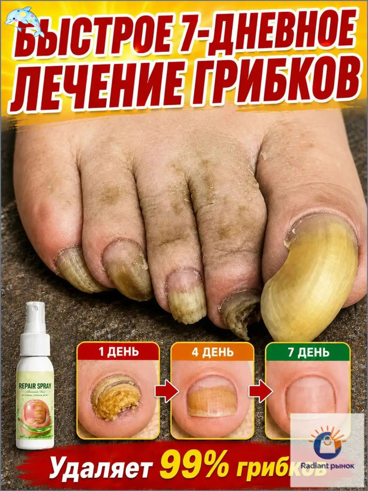 Пилинг #1