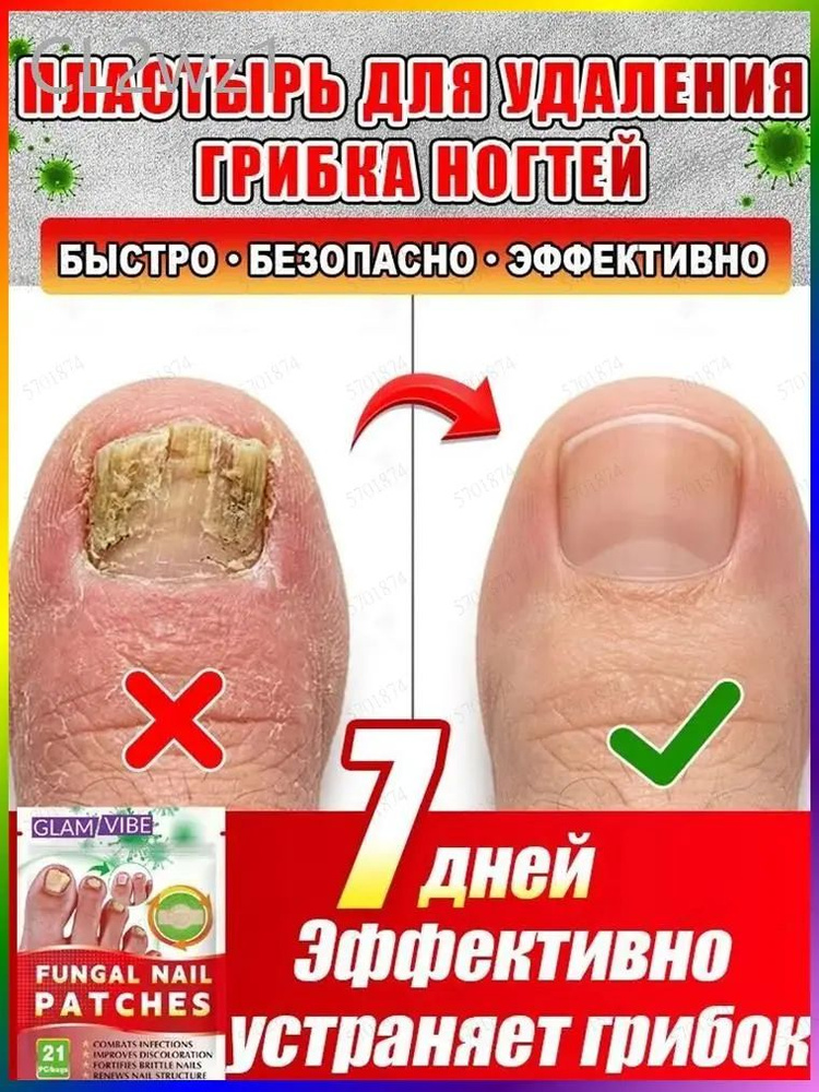 Патчи #1