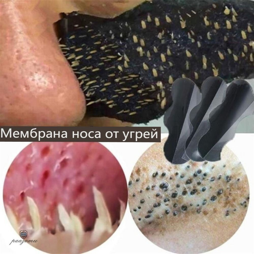 Патчи #1