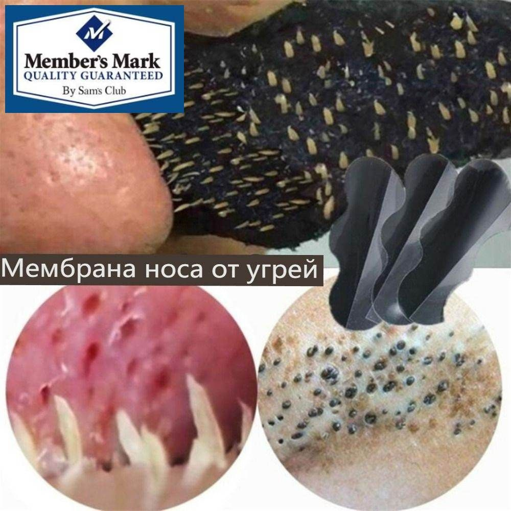 Патчи #1