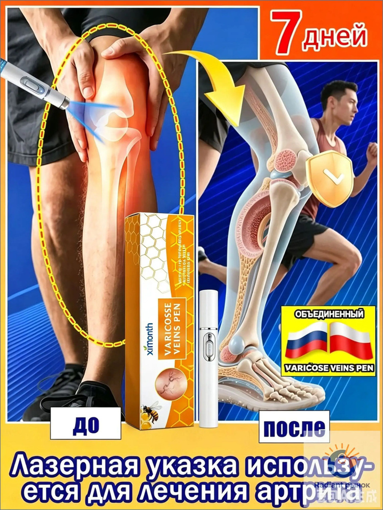 Стик #1
