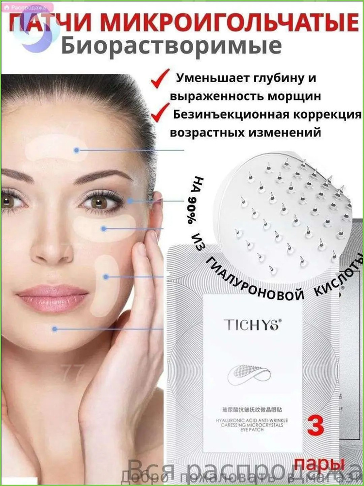 Патчи #1