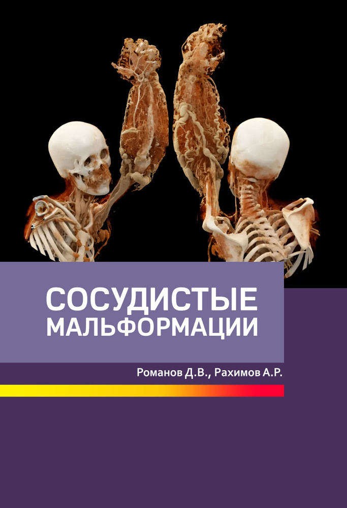 Книга "Сосудистые мальформации" #1