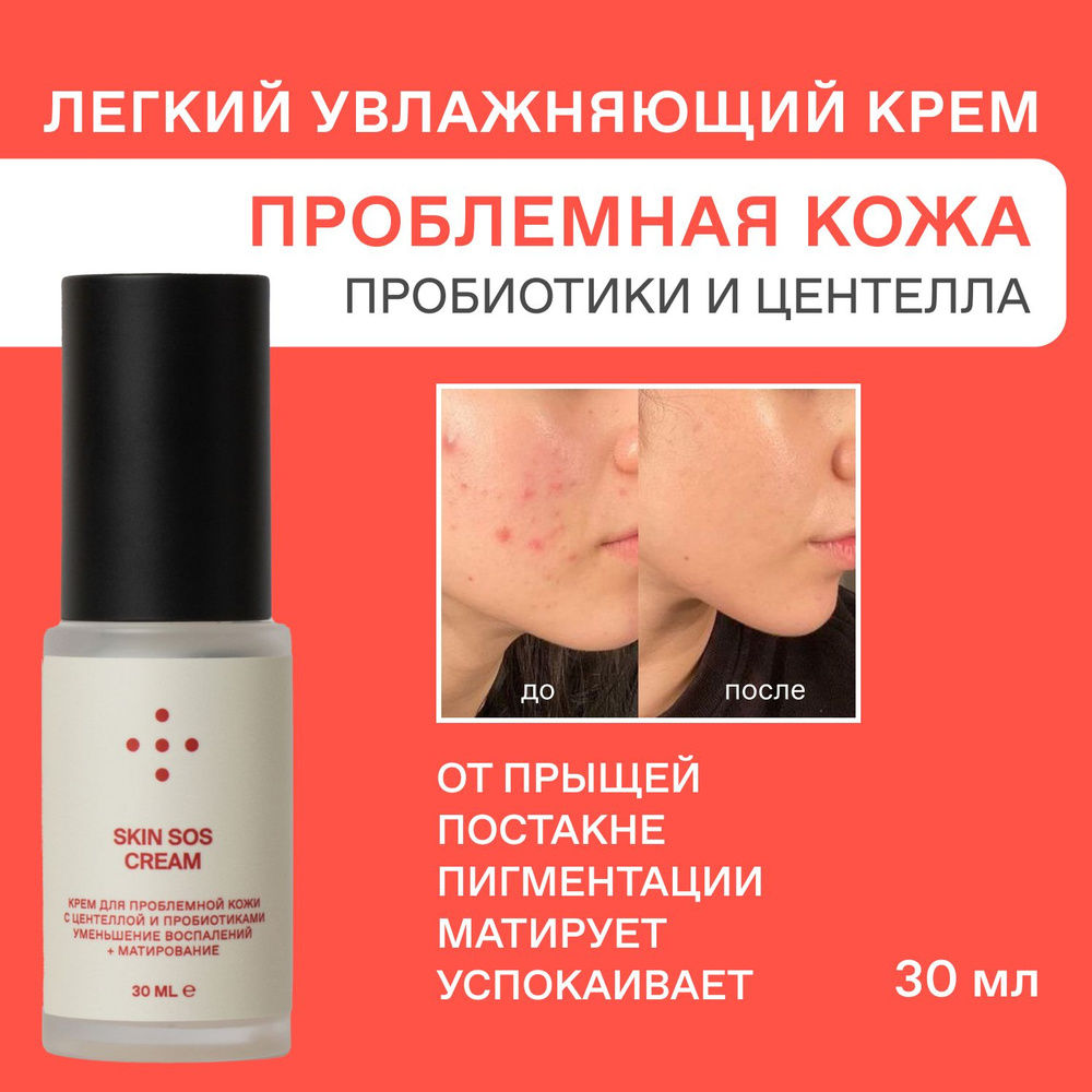 Крем для лица SkinSos увлажняющий для проблемной кожи с центеллой и пробиотиками от прыщей, воспалений, #1