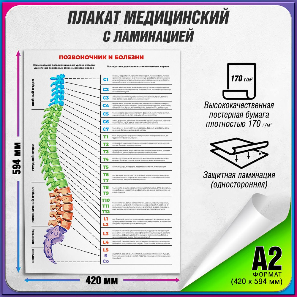 Информационный медицинский плакат "Позвоночник и болезни" / ламинированный / А-2 (42x60 см.)  #1