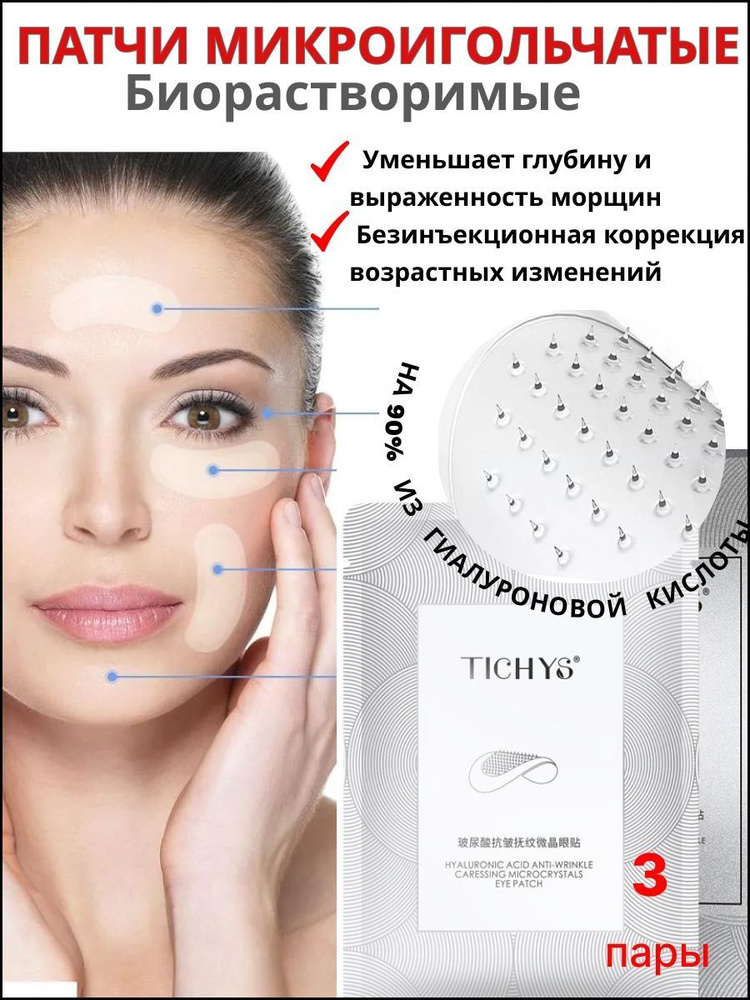 Патчи #1