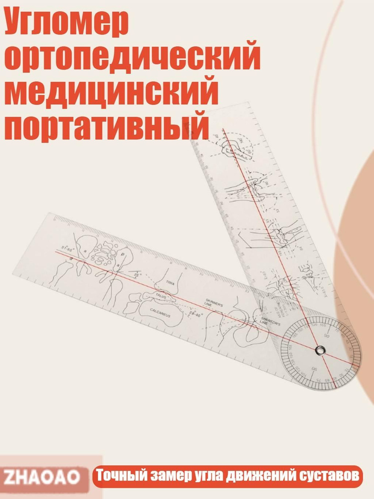 Малка #1