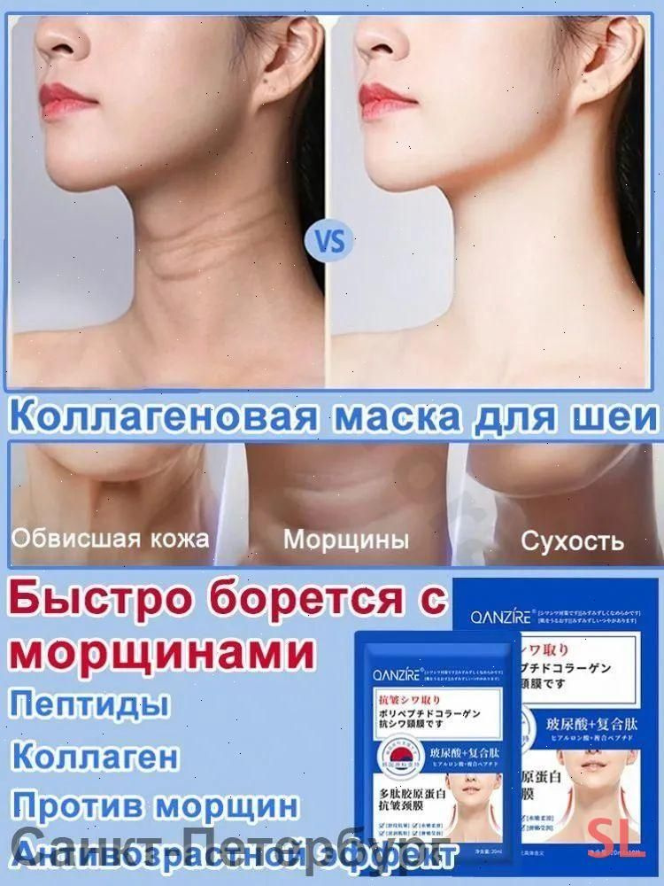 Патчи #1