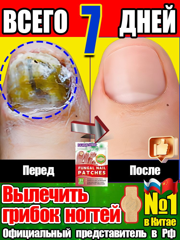 Пилинг #1