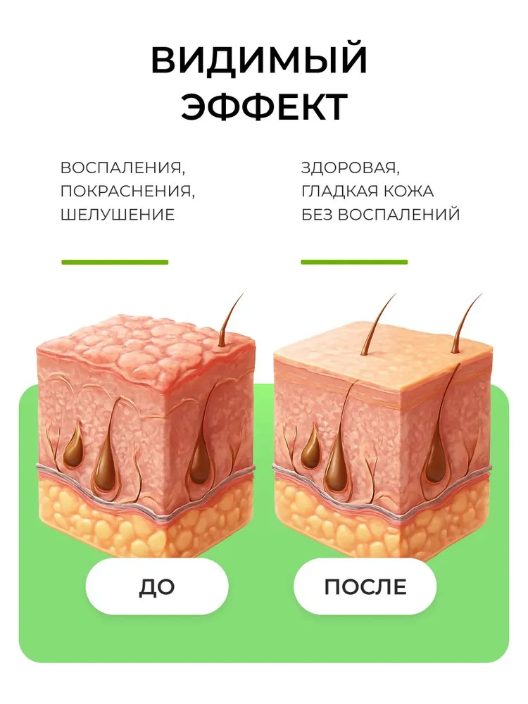 Крем от псориаза, дерматита, сухости и шелушения кожи лица и тела Zudaifu заживляющий / Мазь для рук и ног, лечение экземы и трещин Зудайфу, Китай / Средство от раздражения и зуда, вариант, фото 3
