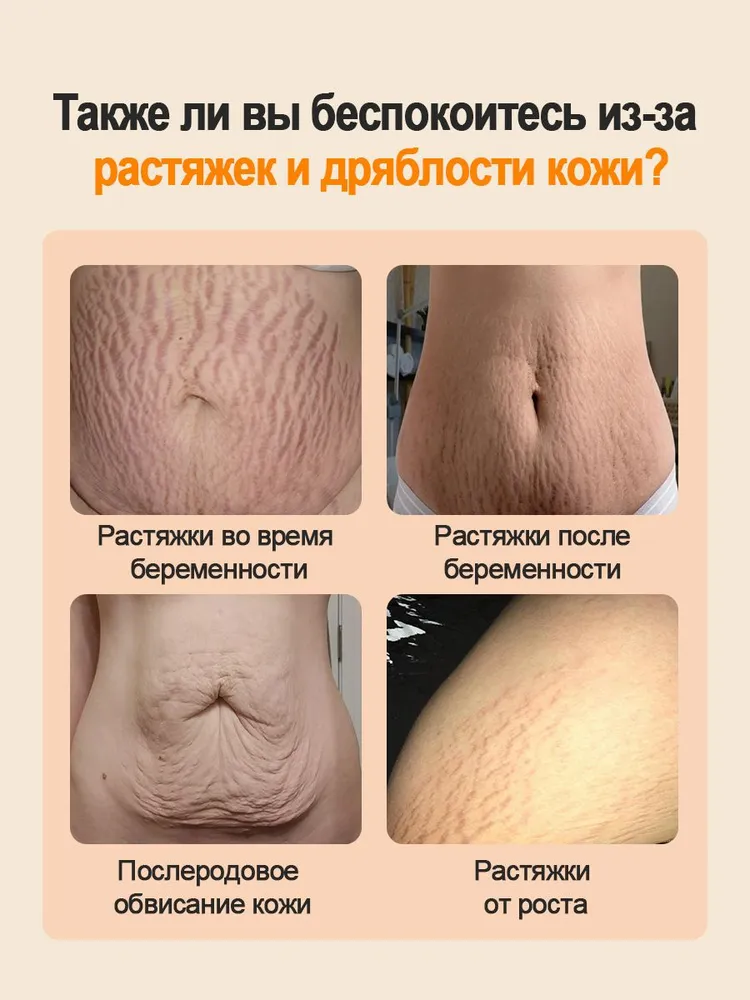 NatureKiss Крем от растяжек,Устранение растяжек, борется с шероховатостью и дряблостью кожи, 60 г, 60 г, фото 2