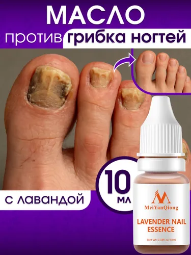 Масло для ногтей от грибка, средство для лечения грибка, " MeiYanQiong", 10 мл, лечение онихолизиса