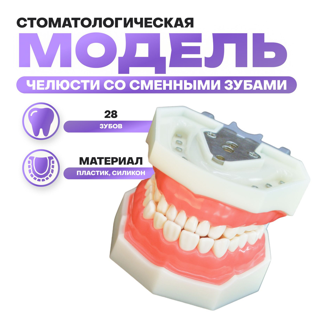 Модель челюсти человека со съемными зубами