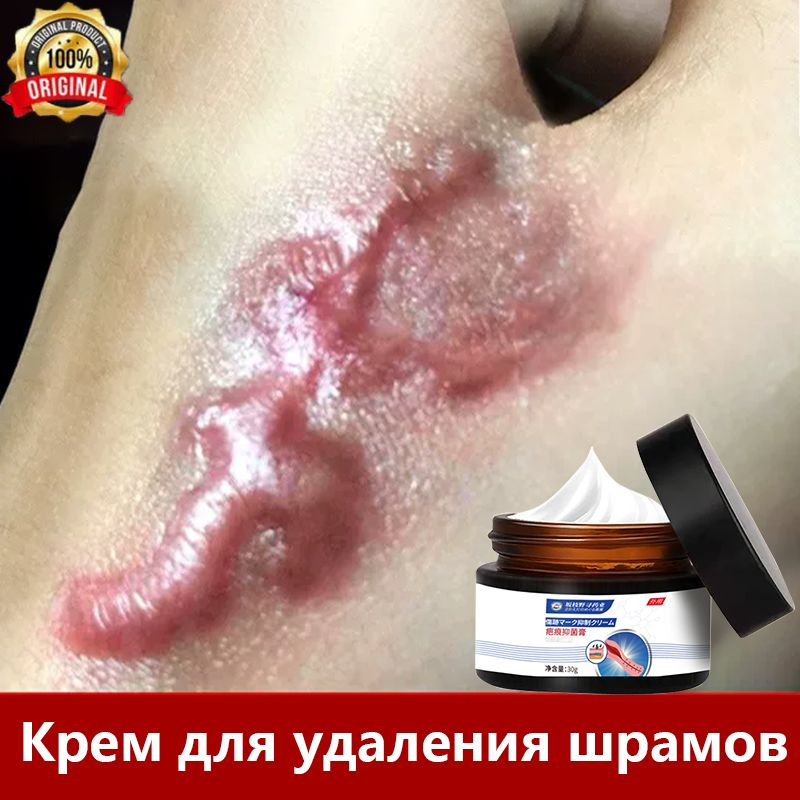 Крем для удаления рубцов 30 г вогнутые и выпуклые шрамы восстановление ...