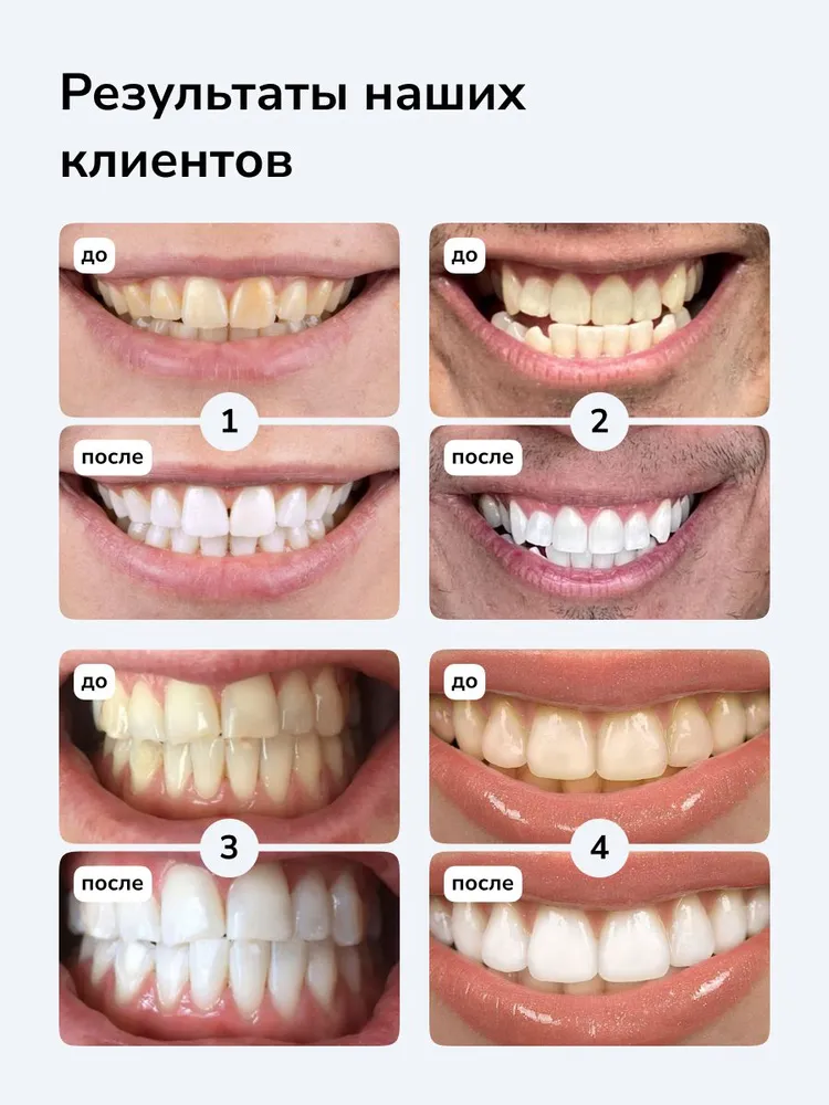 Smilebe Отбеливающие полоски для зубов ProFormula, 28шт. , курс на 14 дней, 28 шт, фото 4