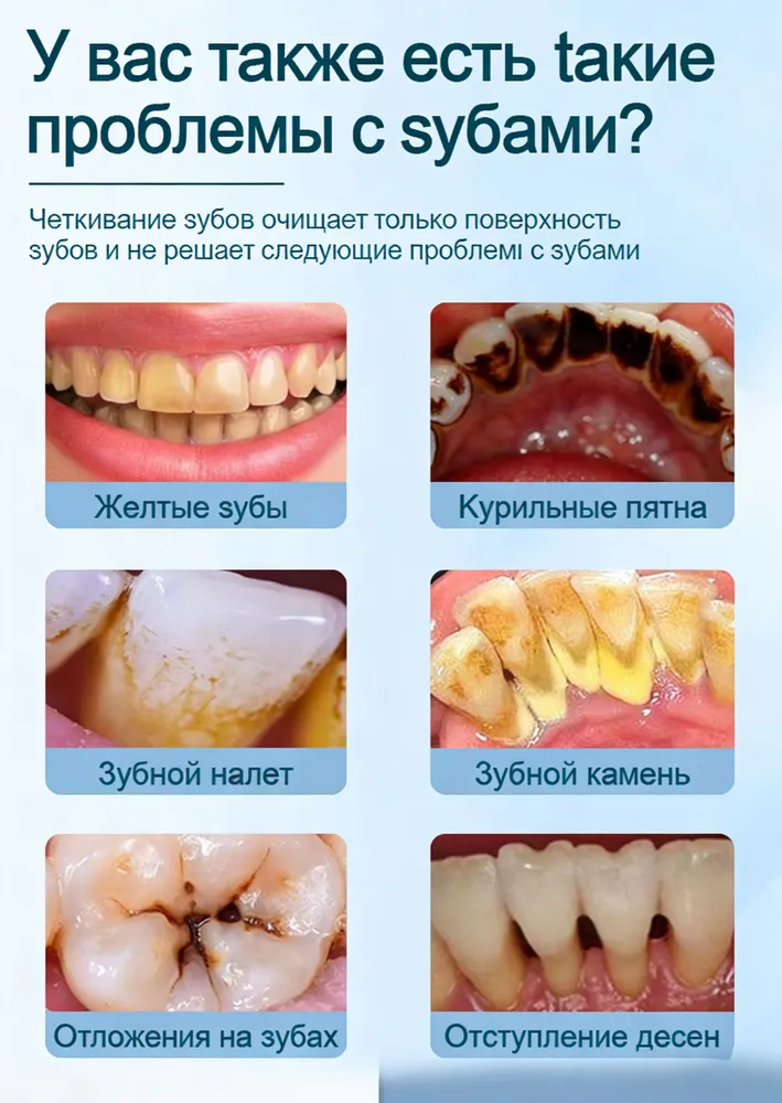 Скалер ультразвуковой для удаления зубного камня. Скалер для зубов от налета и кариеса, отбеливание зубов, вариант, фото 5