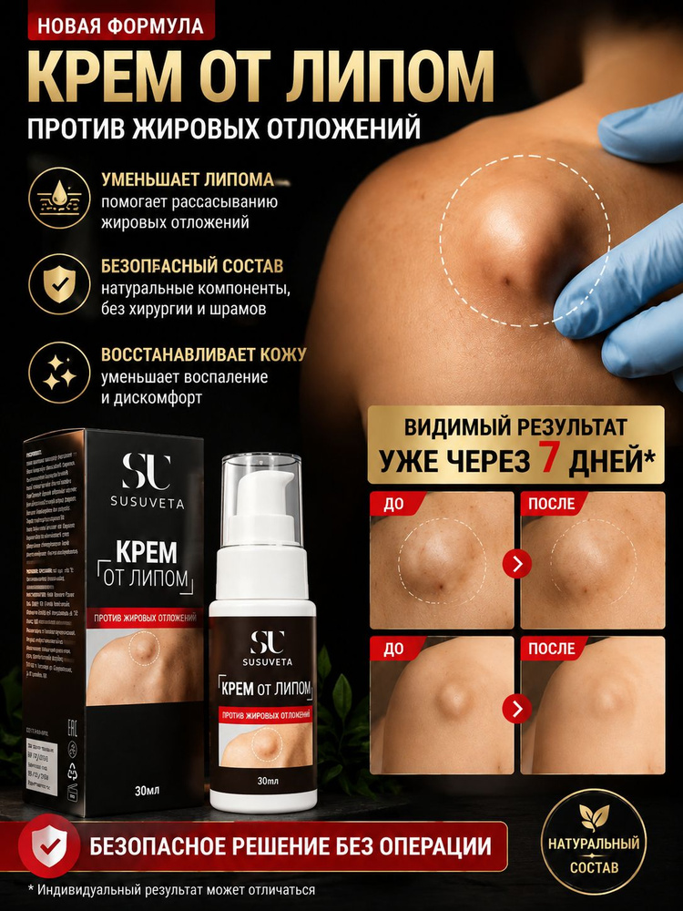 Крем от липом и жировиков, 30 г натуральный травяной состав, быстро рассасывает подкожные жировые узлы #1