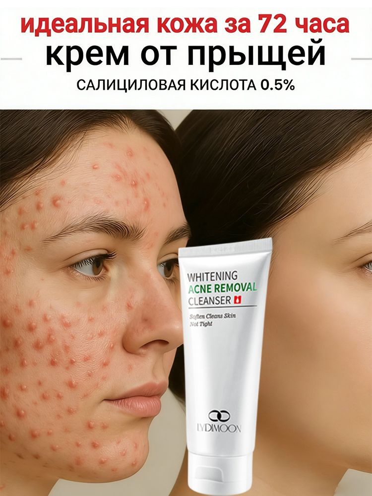 Очищающая пенка для умывания, подходит для чувствительной, жирной и склонной к акне кожи. Используется #1