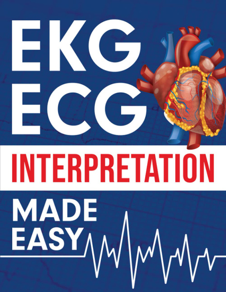 EKG ECG Interpretation Made Easy: An Illustrated Study Guide For ...