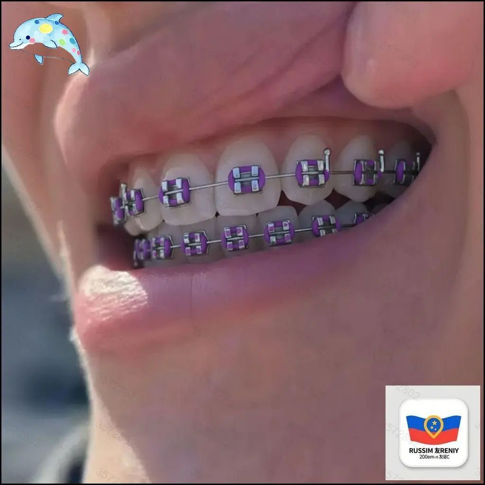 Грилзы #1