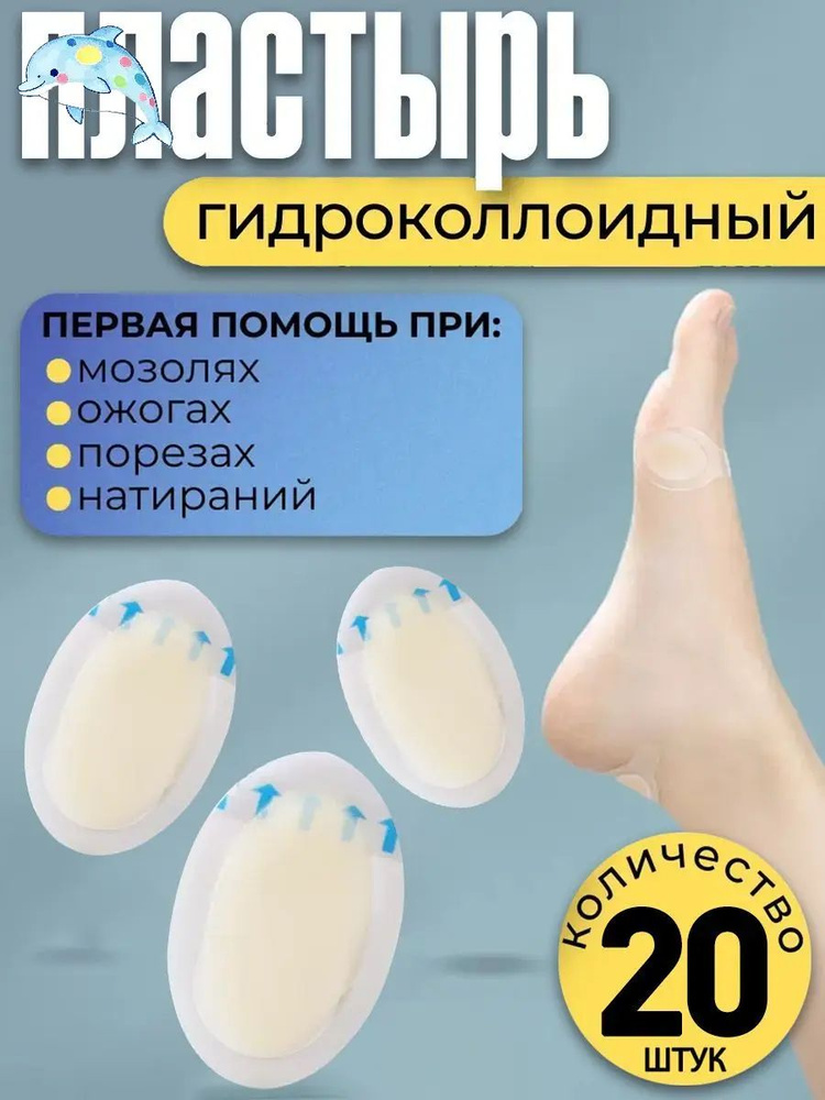 Патчи #1
