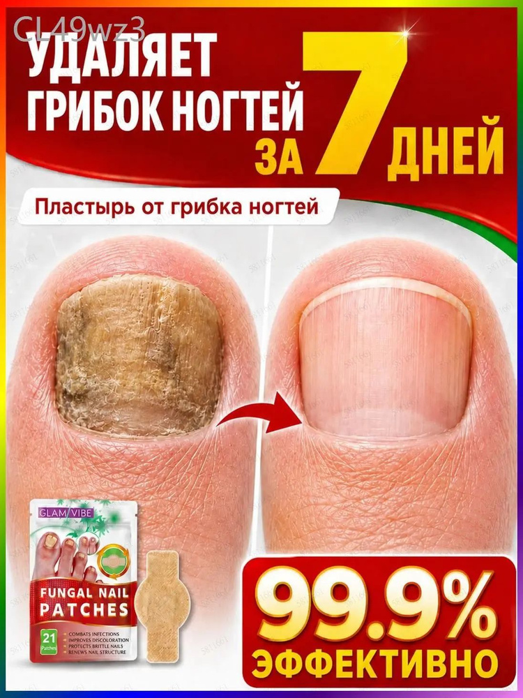 Патчи #1