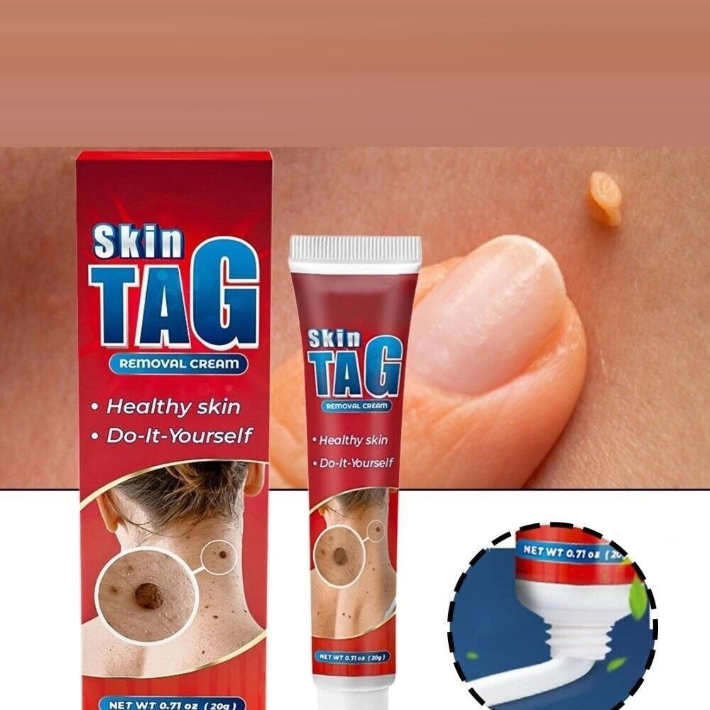 Мазь для удаления бородавок и папиллом 20г "Sumifun Skin Tag" #1