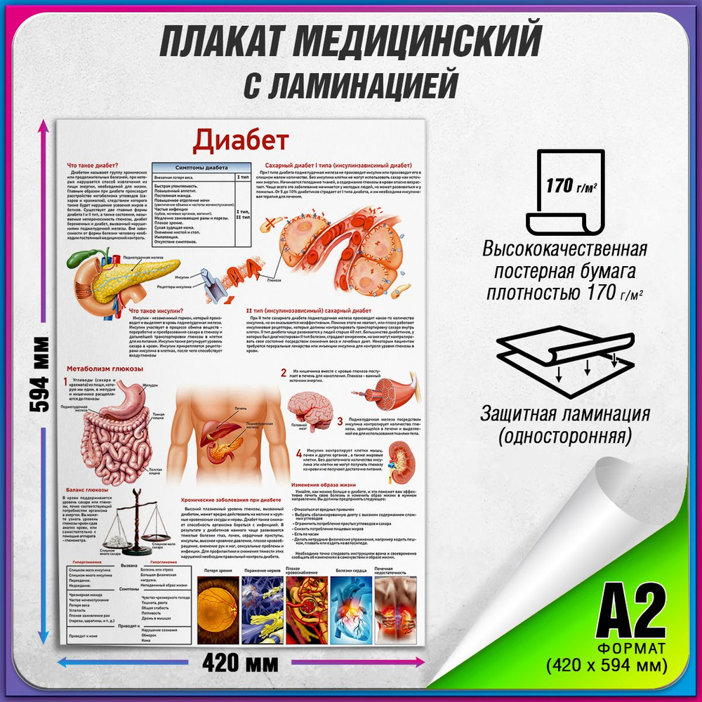 Информационный медицинский плакат "Диабет" / ламинированный / А-2 (60x42 см.)  #1