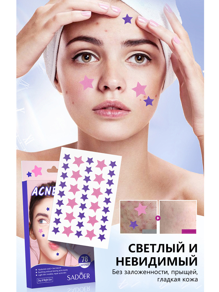 Патчи #1