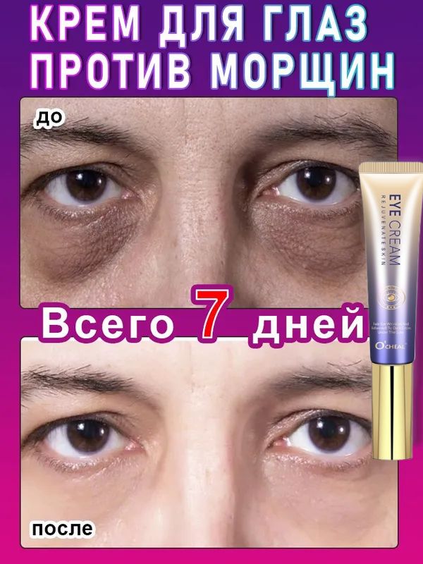 кремдляглазпротивморщин,векикоживокругглазот,отековитемныхкруговслифтинг-эффектом,20г