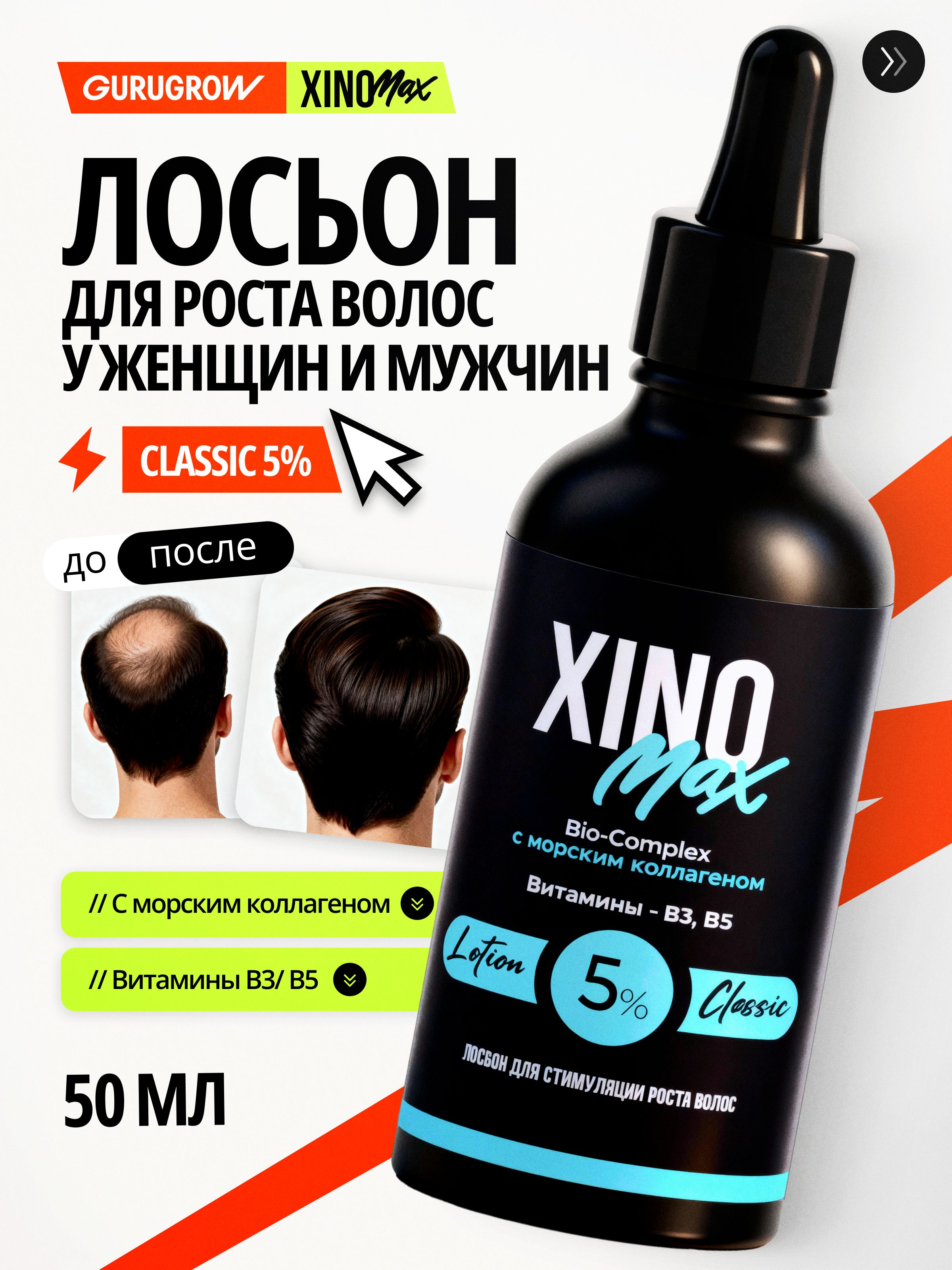 Xinomax 5% лосьон для роста волос и бороды, 50 мл купить на OZON