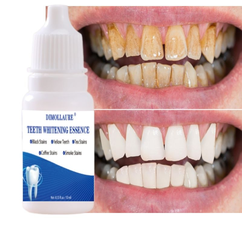 Зубной порошок быстродействующая эссенция для отбеливания зубов для ...