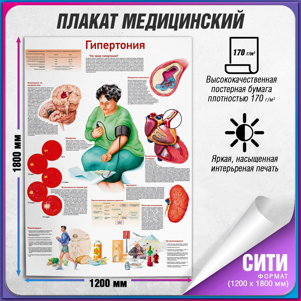 Информационный медицинский плакат "Гипертония" / Сити (120x180 см.)  #1