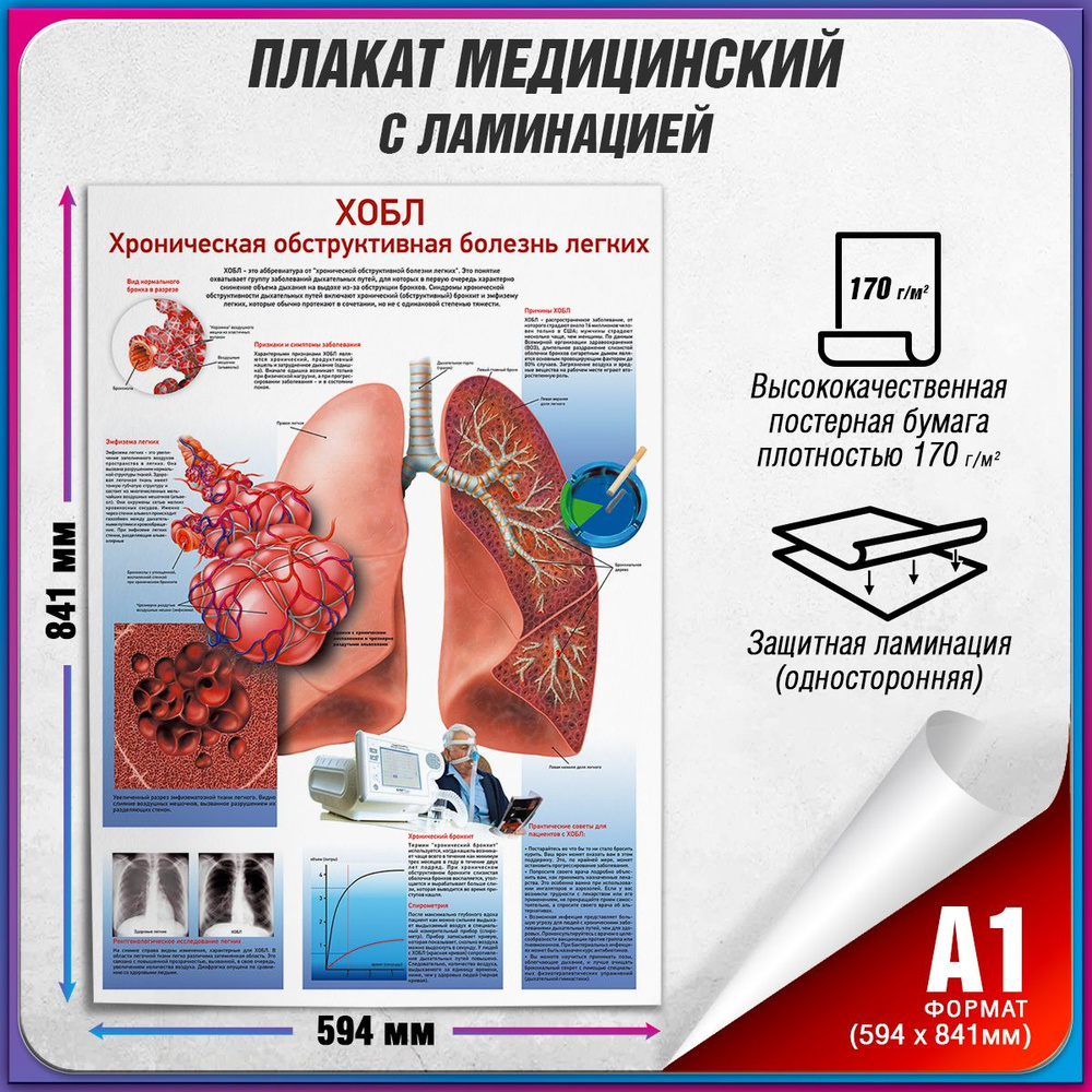 Информационный медицинский плакат "Хобл: Хроническая обструктивная болезнь легких" / ламинированный / #1