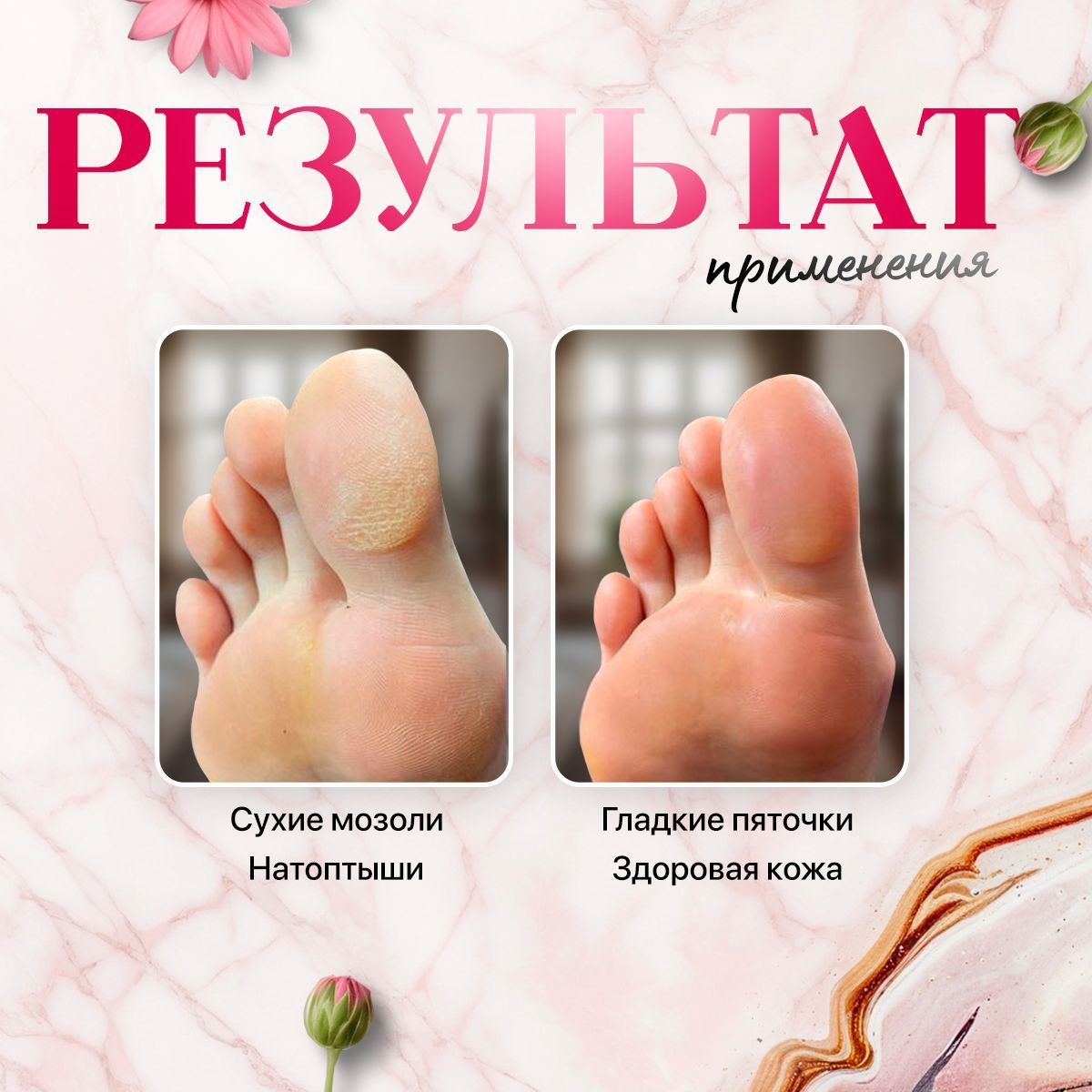 Терка педикюрная для пяток двусторонняя купить на OZON по низкой цене ...