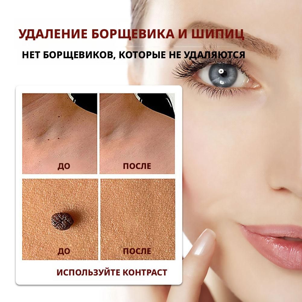 Суперчистотелокарандашотпапилломибородавок3ml
