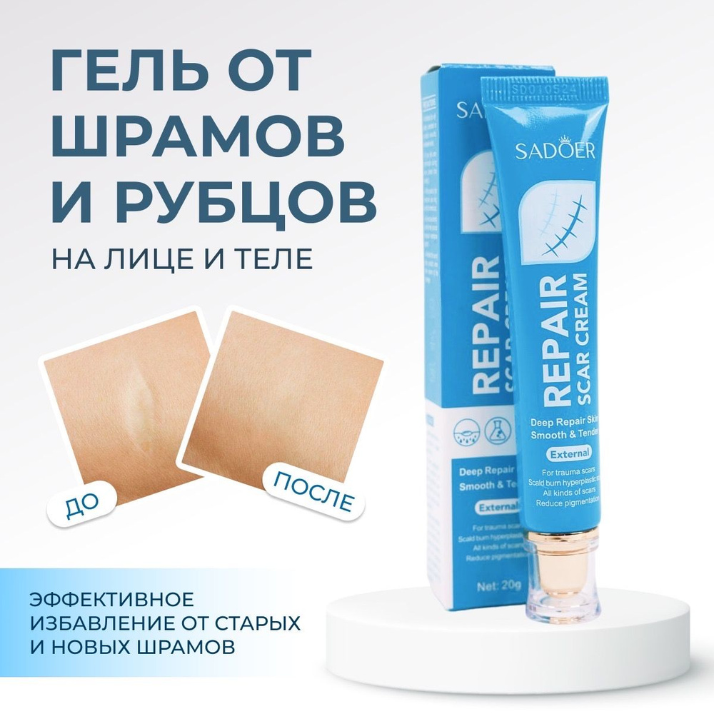 Заживляющий крем от шрамов, рубцов, ожогов, постакне. - купить с ...