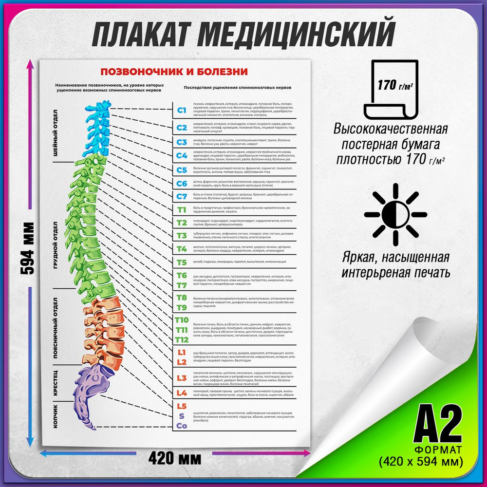 Информационный медицинский плакат "Позвоночник и болезни" / А-2 (42x60 см.)  #1