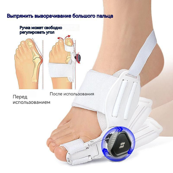 Корректор вальгусной деформации стопы, разделитель перекрытия большого ...