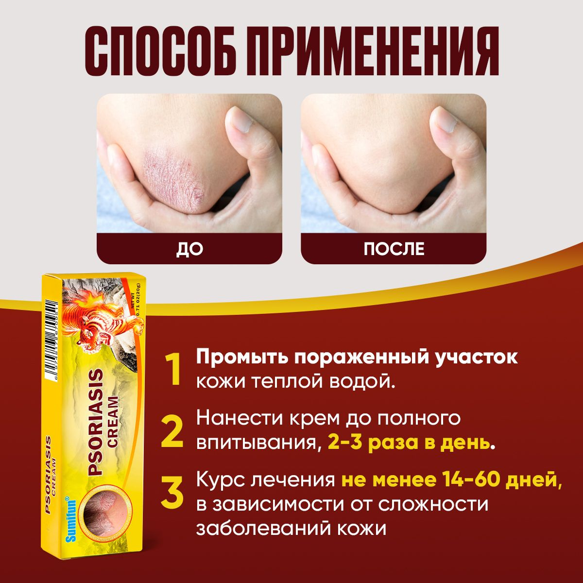 Мазь от ПСОРИАЗА, экземы, атопического дерматита / Китайская чудо мазь ...