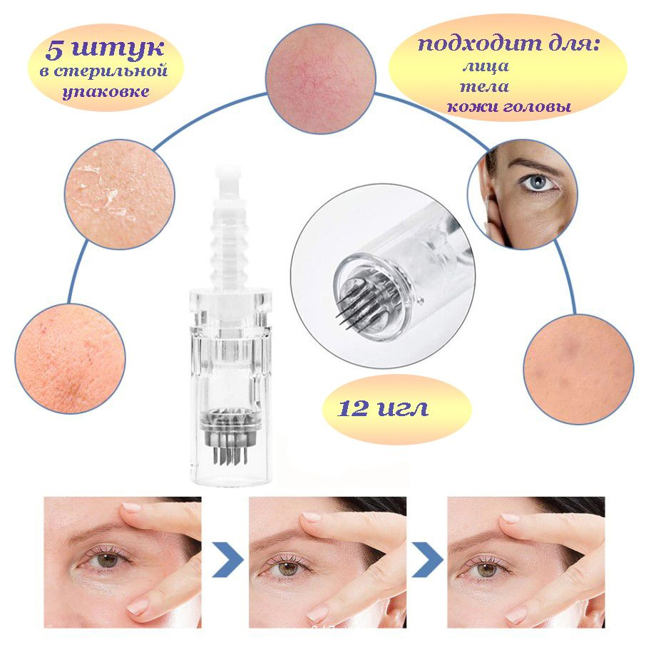 Картридж Байонет на 12 игл, 5 шт. Насадка для фракционной мезотерапии на аппараты: My-M, Ultima A1, N2, #1