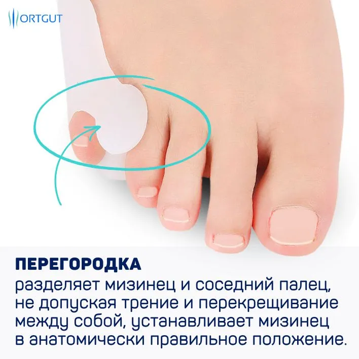 ORTGUT Силиконовый фиксатор мизинца стопы с защитной накладкой / Разделитель с межпальцевой перегородкой / Накладка для комфортного ношения обуви, вариант, фото 2