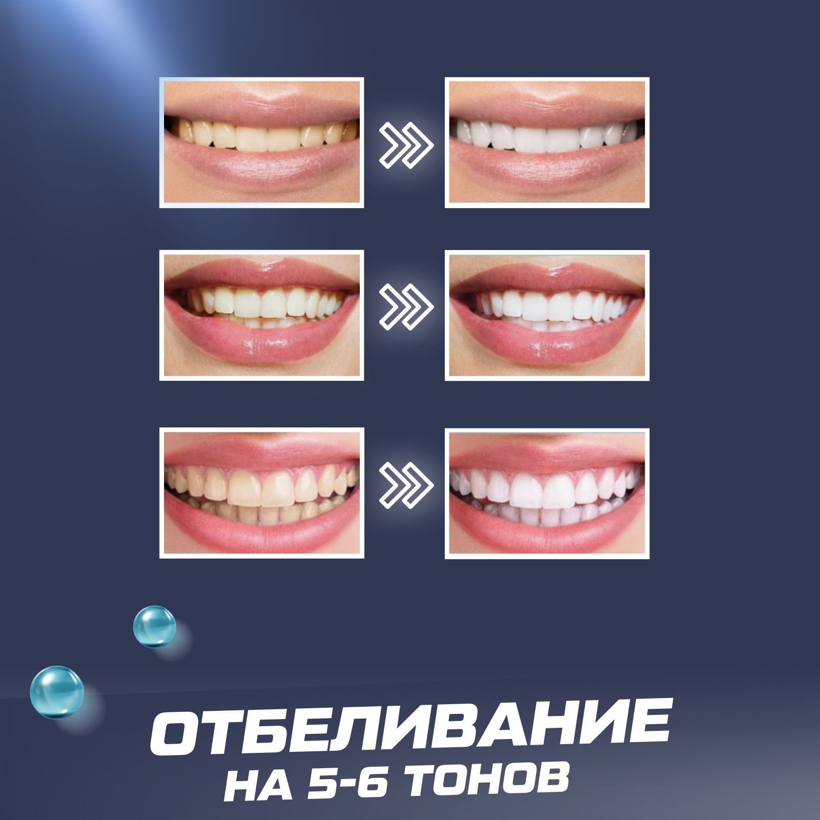 Премиум отбеливание зубов. Полоски Perfect Smile 28 штук, безопасное отбеливание  зубов курс 14 дней без перекиси в домашних условиях без пятен с PAP  компонентом осветление налёт кофе сигарет чай камень улыбка за