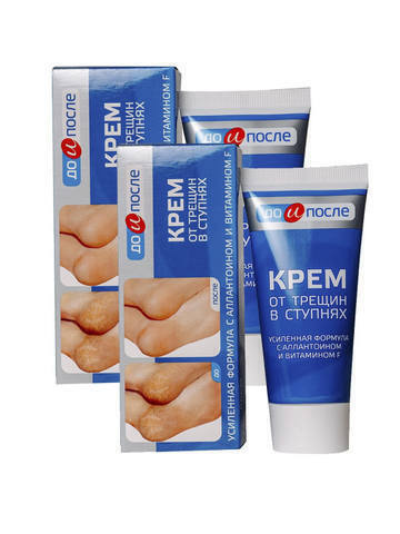 Крем от трещин в ступнях "До и После", 50 мл, 2 шт. - купить с ...