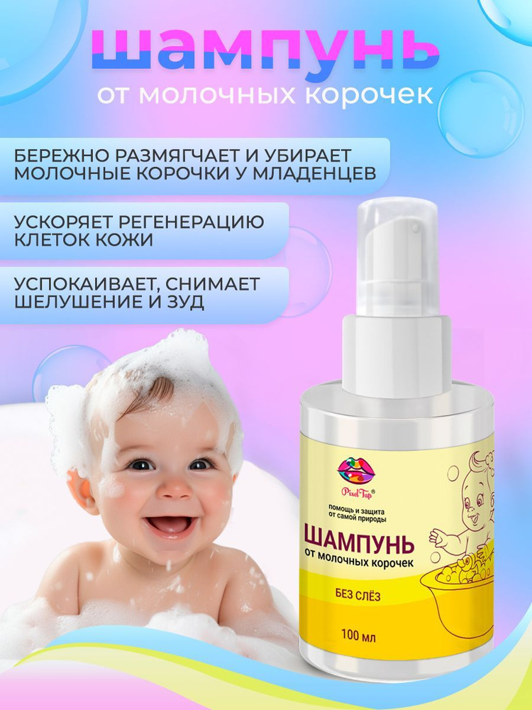 «Молочные корочки» у малышей