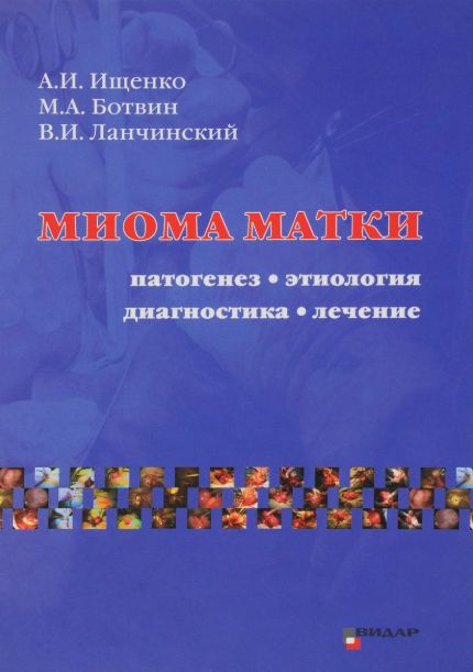 Миома матки. Этиология, патогенез, диагностика, лечение - купить с ...