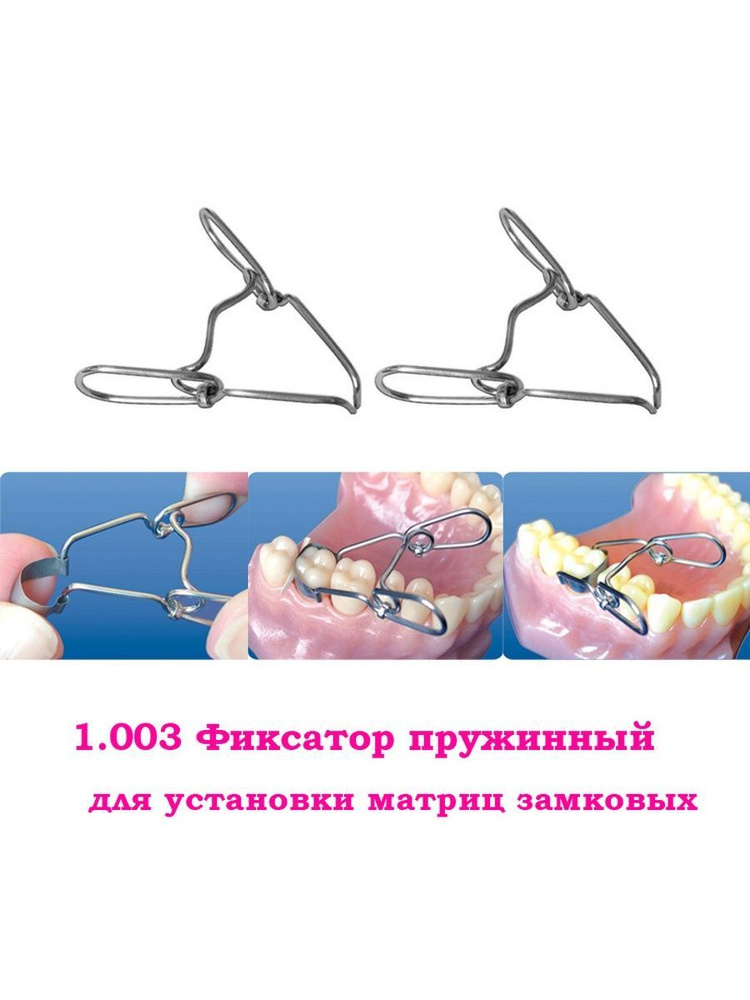 1.003 Матрицедержатель пружинный фиксатор замыкающий для установки ...