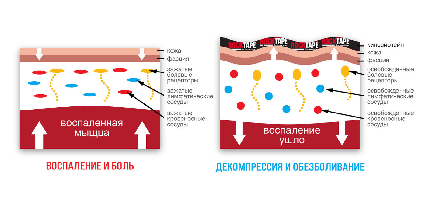 Как работают тейпы картинки