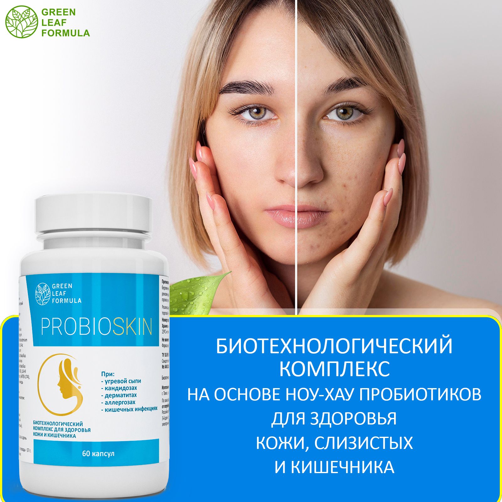 Таблетки от прыщей и черных точек на лице, средство от молочницы ...